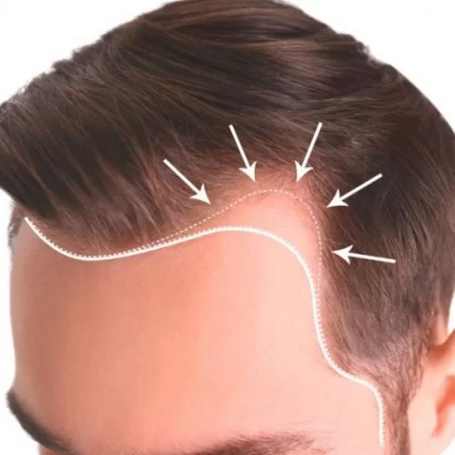 Yılan Yapısı 1556811759