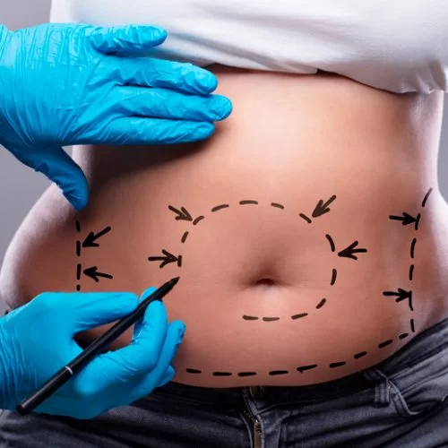 Yılan Yapısı 1653513930