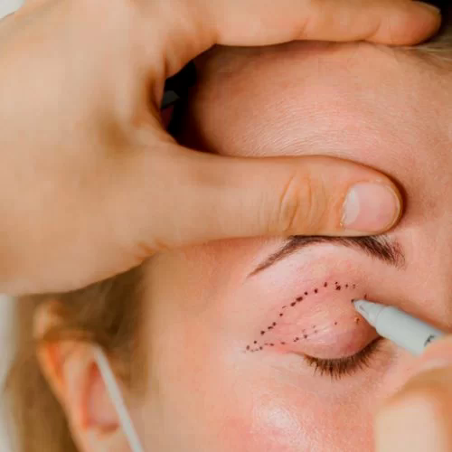 Yılan Yapısı 640144223