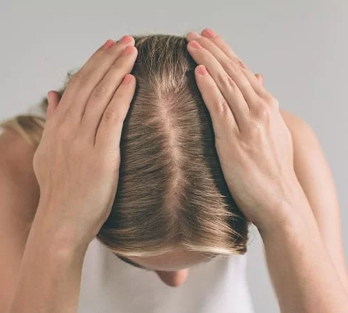 Yılan Yapısı 1213052642