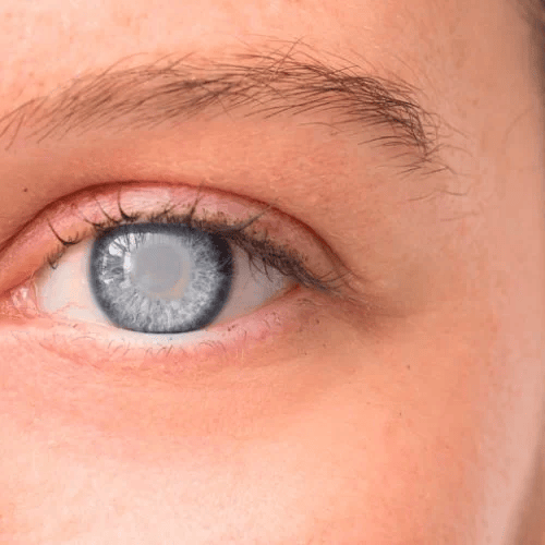 Yılan Yapısı 1200247758