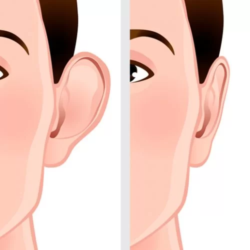 Yılan Yapısı 1810770606