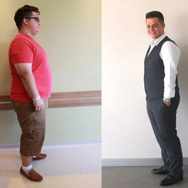 Yılan Yapısı 457416861