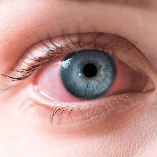 Yılan Yapısı 266259900