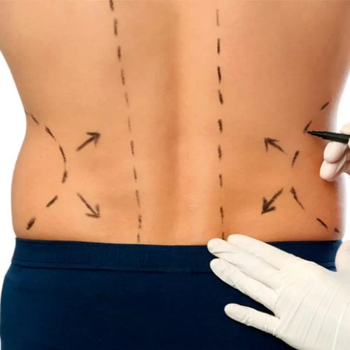 Yılan Yapısı 693869510