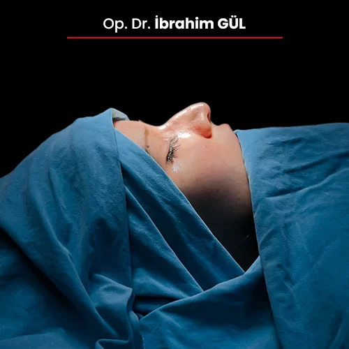 Öncesi Sonrası 1243783003