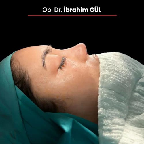 Öncesi Sonrası 1450053484