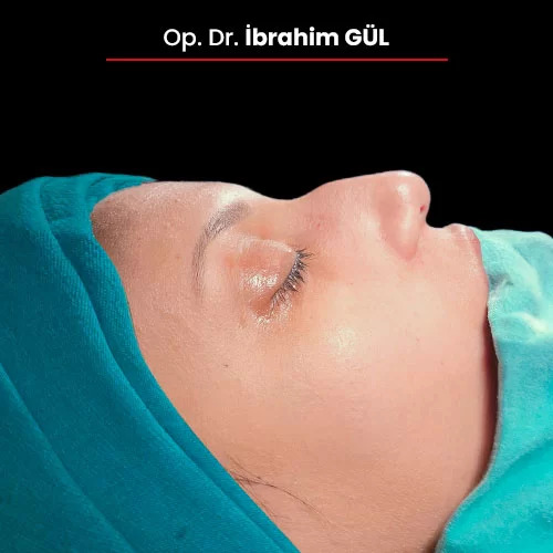 Öncesi Sonrası 751041890