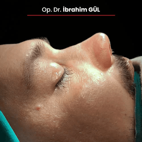 Öncesi Sonrası 218622302