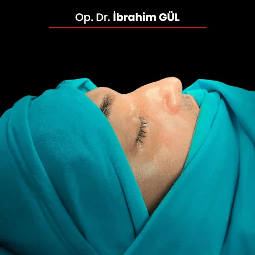 Öncesi Sonrası 1542984374