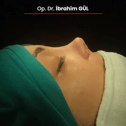 Öncesi Sonrası 812377066