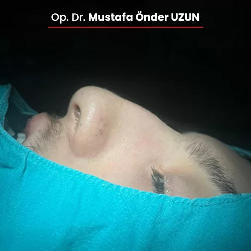 Öncesi Sonrası 1080784905