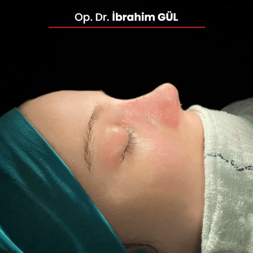 Öncesi Sonrası 123985098