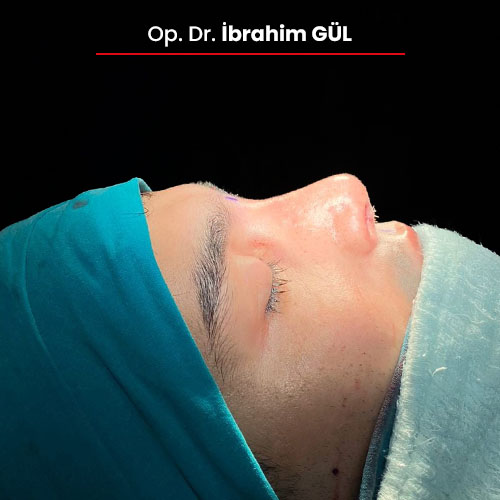 Öncesi Sonrası 907218330