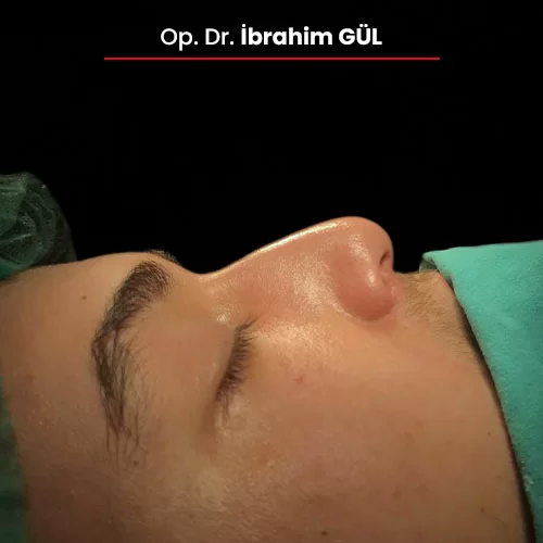 Öncesi Sonrası 781199278