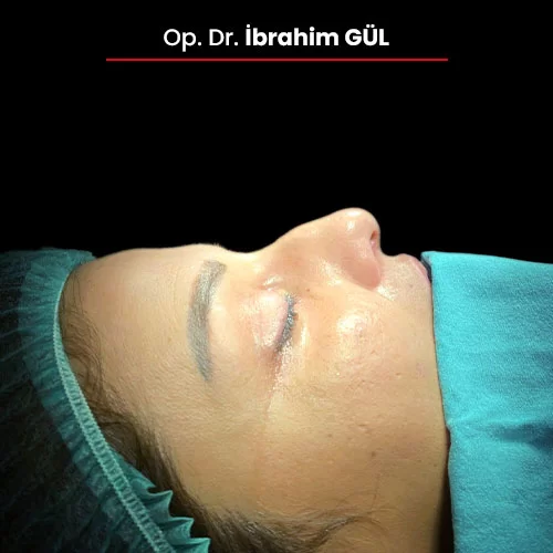 Öncesi Sonrası 2092172131