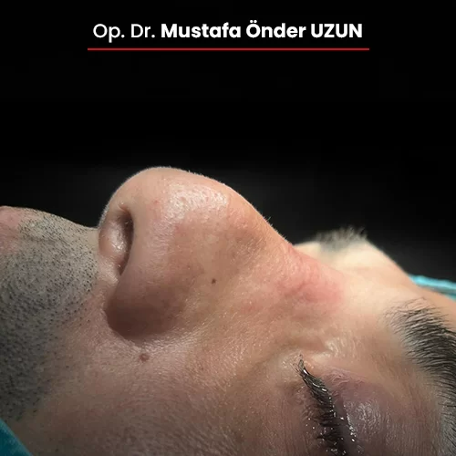 Öncesi Sonrası 670659560