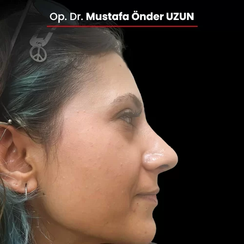 Öncesi Sonrası 1200112467