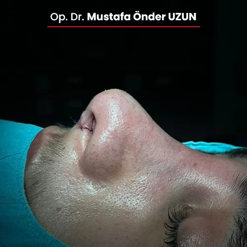 Öncesi Sonrası 289107363