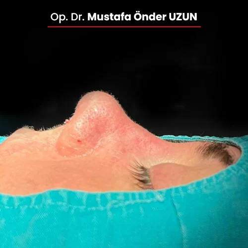 Öncesi Sonrası 1847402041