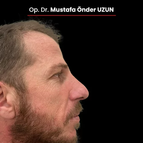 Öncesi Sonrası 342691060