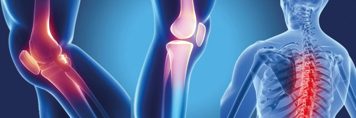 Ортопедия И Травматология