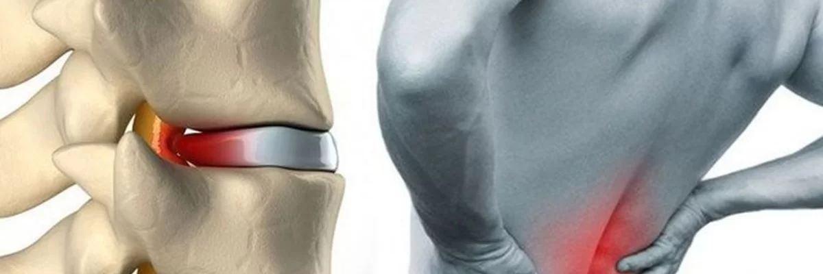 Неврохирургия